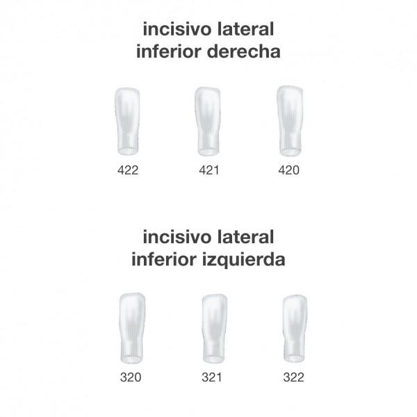 CORONAS INCISIVO LATERAL INFER. FRASACO – Ideiglenes koronák