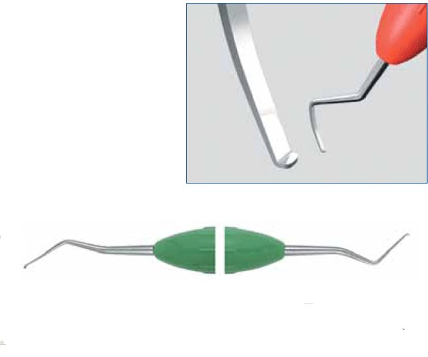 ERGOACCESS CURETA AZADA 112-156 – LM ergonomikus parodontális küret