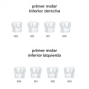 CORONAS PRIMER MOLAR INFER. FRASACO – Coronas acero inoxidable